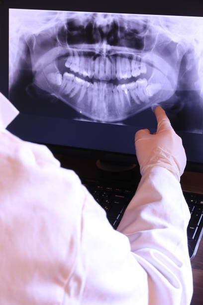 Best Emergency Root Canal Treatment in Deer Park, IL